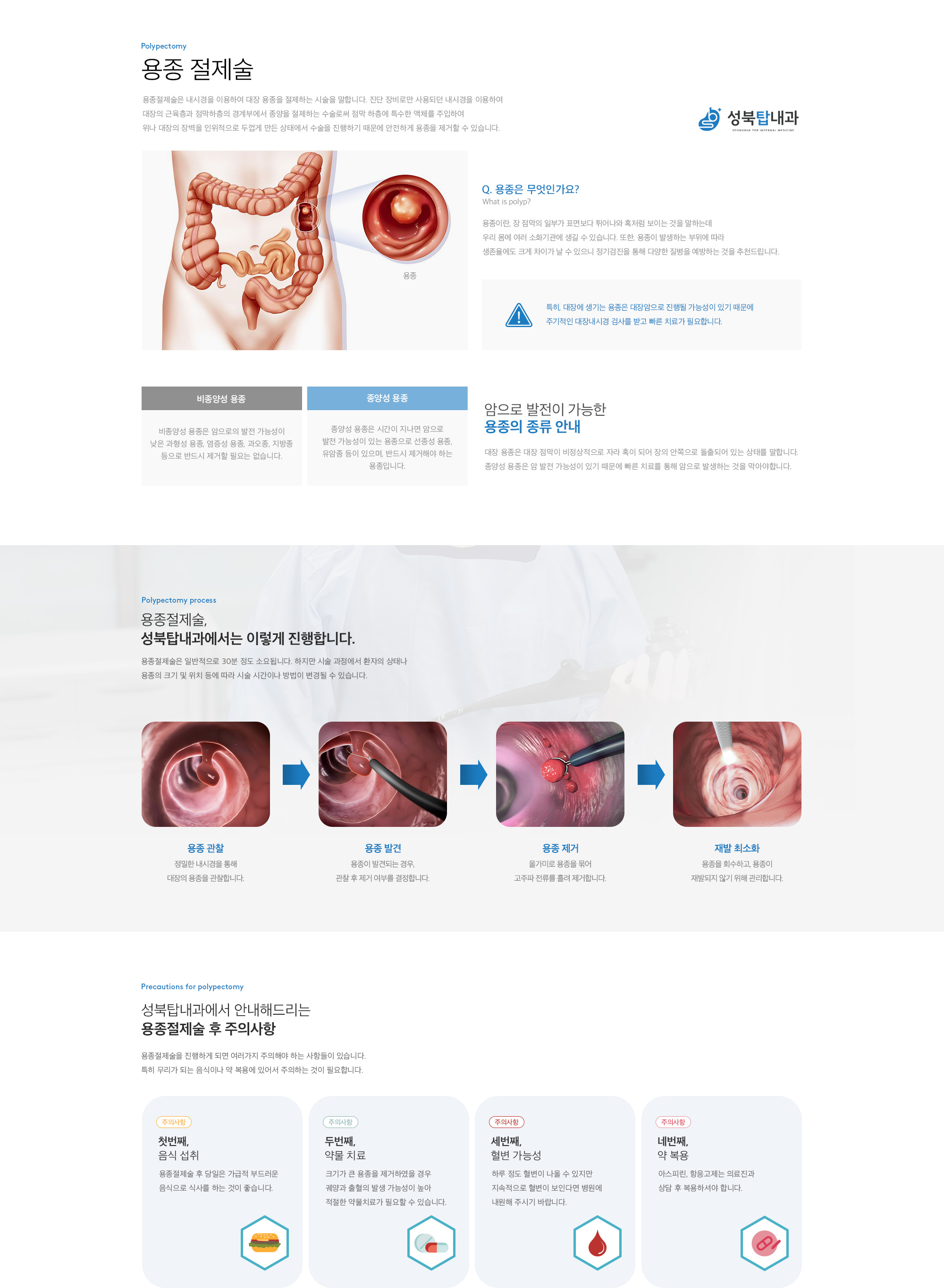 용종절제술